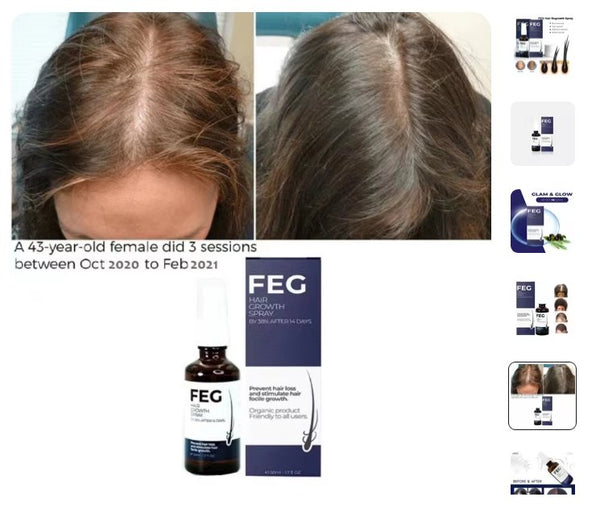 FEG Plus Hair Growth Spray (Original)